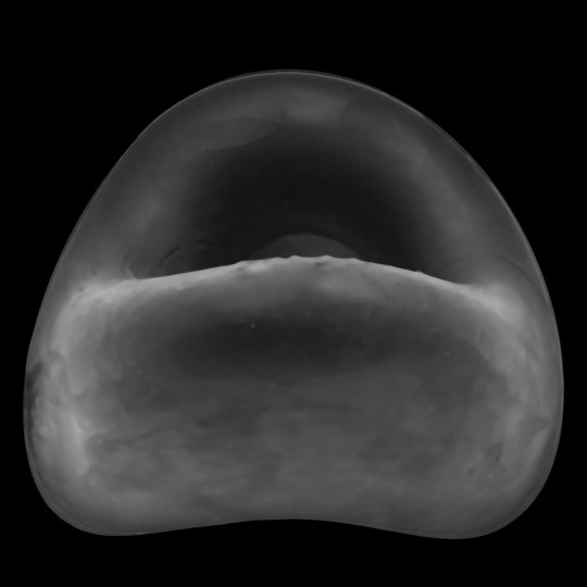 FORM SURROUND Silicone Cockring Oxballs HünkyJünk